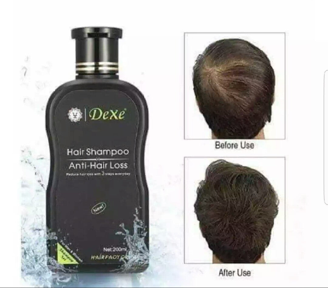Organic Hair Growth/ Anti-hair Loss Shampoo (Buy 1 Take 1 Promo)